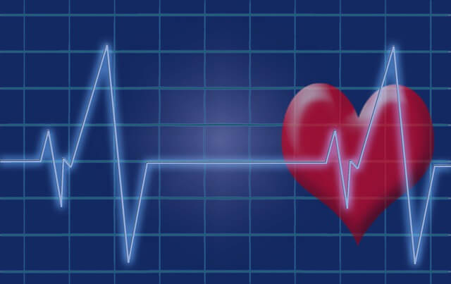 Fibrilação atrial